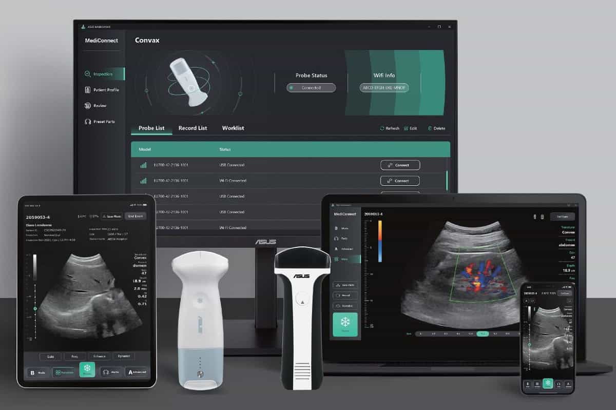 ASUS AI infused Taiwanese Healthcare System Ultrasound